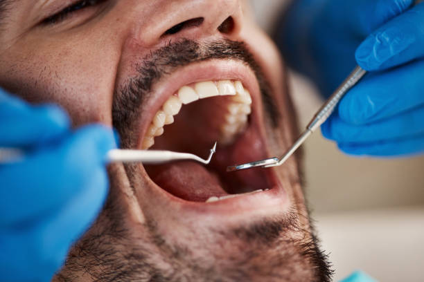 Best Emergency Dental Care for Trauma or Injury in Capac, MI